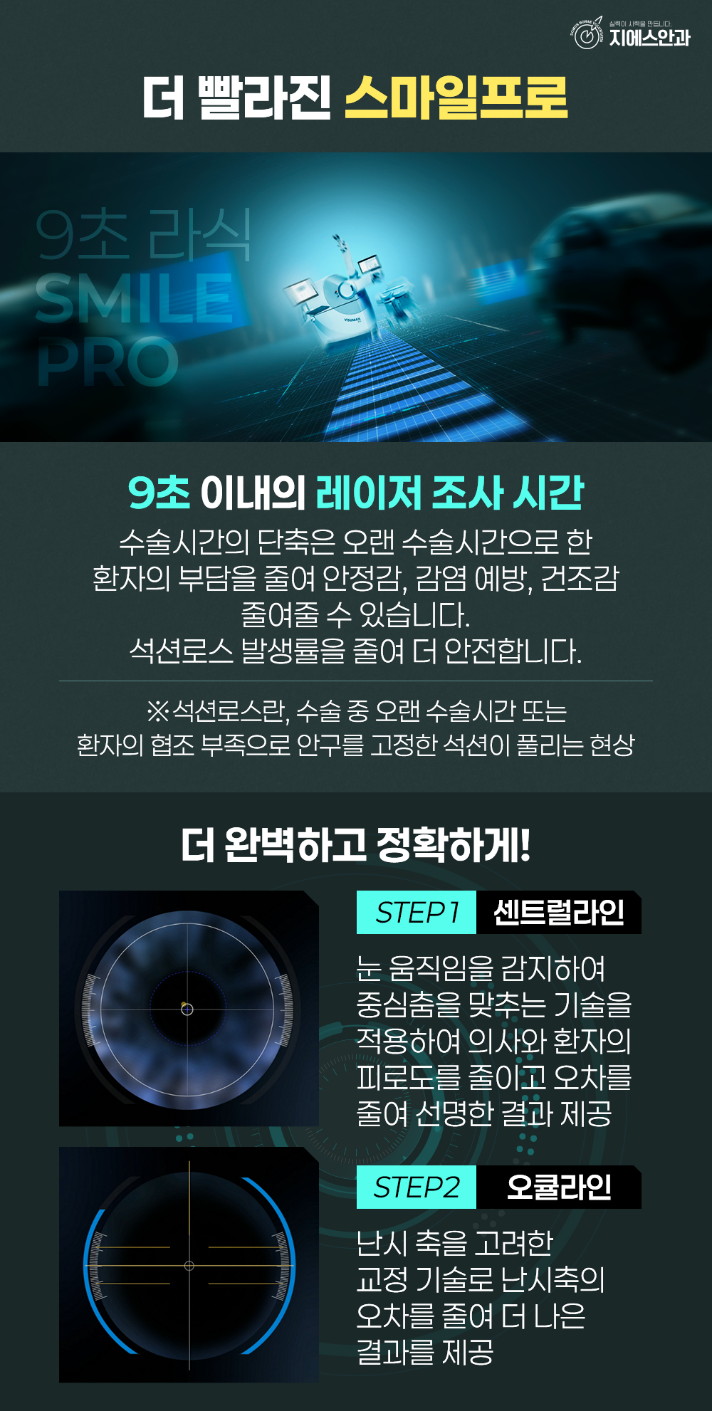 스마일라식회복기간 단계별 변화와 일상 복귀 핵심 정보 10 1776826450 9