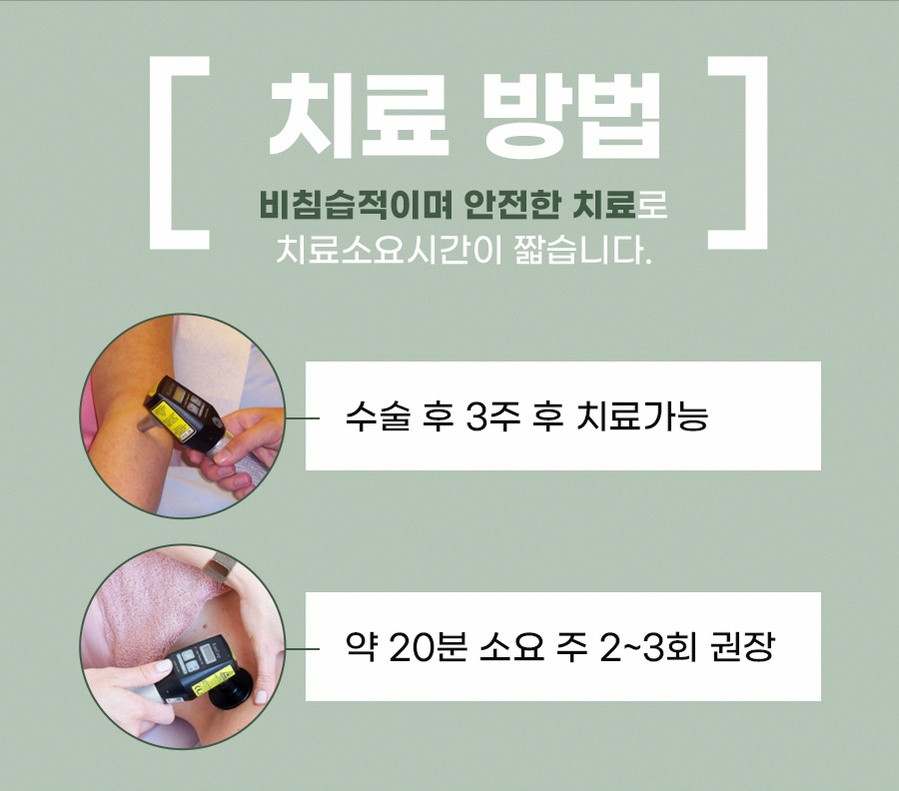 본문 내용을 보조하는 이미지