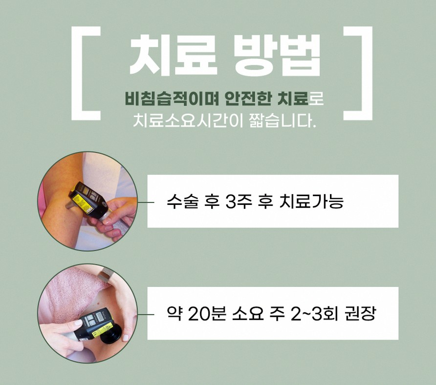 본문 내용을 보조하는 이미지