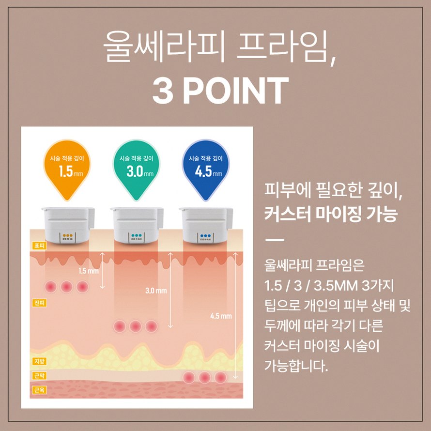 평촌울쎄라 시술 전 알아두면 좋은 5가지 핵심 정보