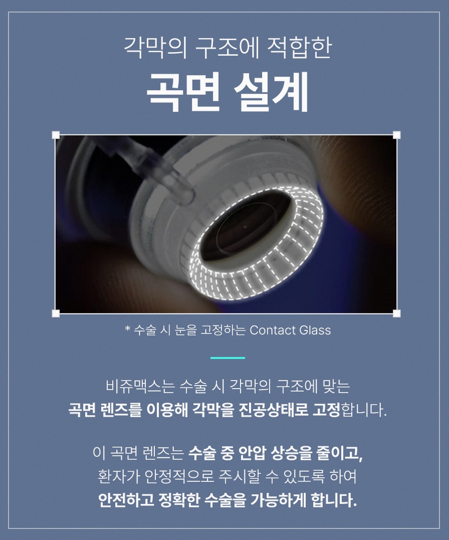 강남스마일라식 후회 없는 선택을 위한 5가지 핵심 정보 11 1773912045 10 7c9674a4