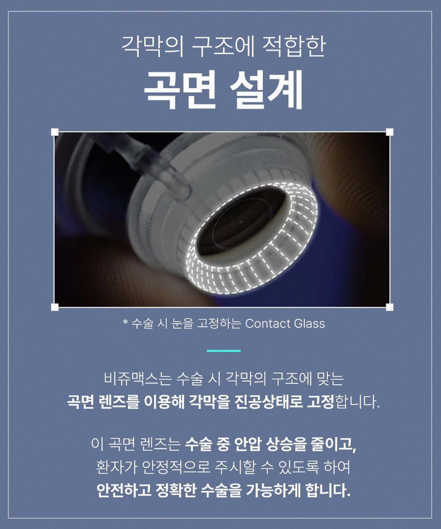 스마일라식수술시간 실제 소요시간과 회복기간 핵심 정보 11 1773912045 10 aa64771b