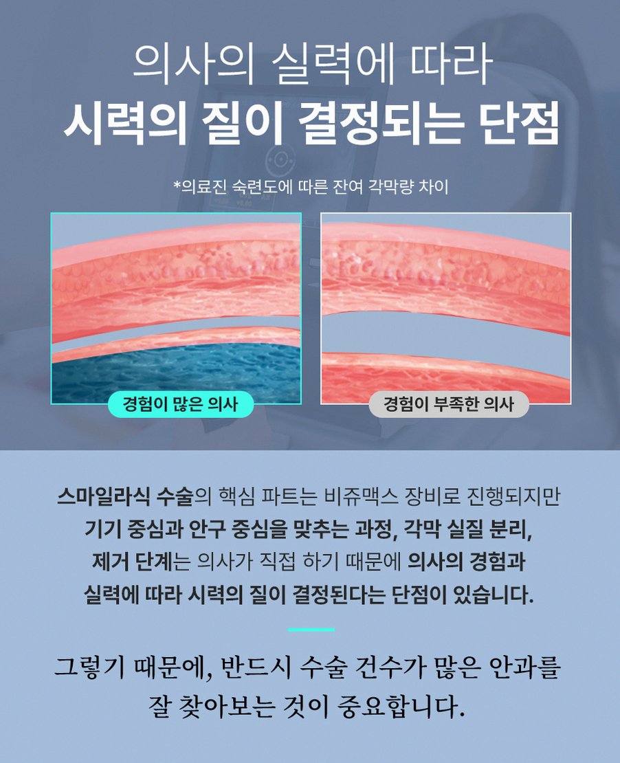 스마일라식수술시간 실제 소요시간과 회복기간 핵심 정보 13 1773912045 12 238f9595