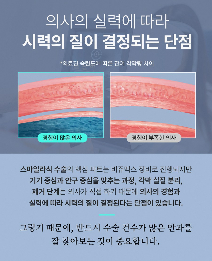 강남스마일라식비용 합리적 범위와 숨은 추가비용 포인트 13 1773912045 12 624b0396