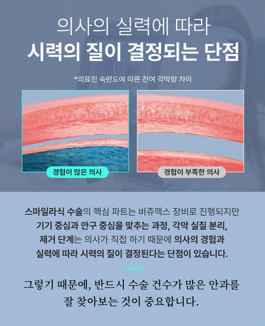 강남스마일라식효과 후회 줄이는 3가지 핵심 포인트 13 1773912045 12 e2dcb14b