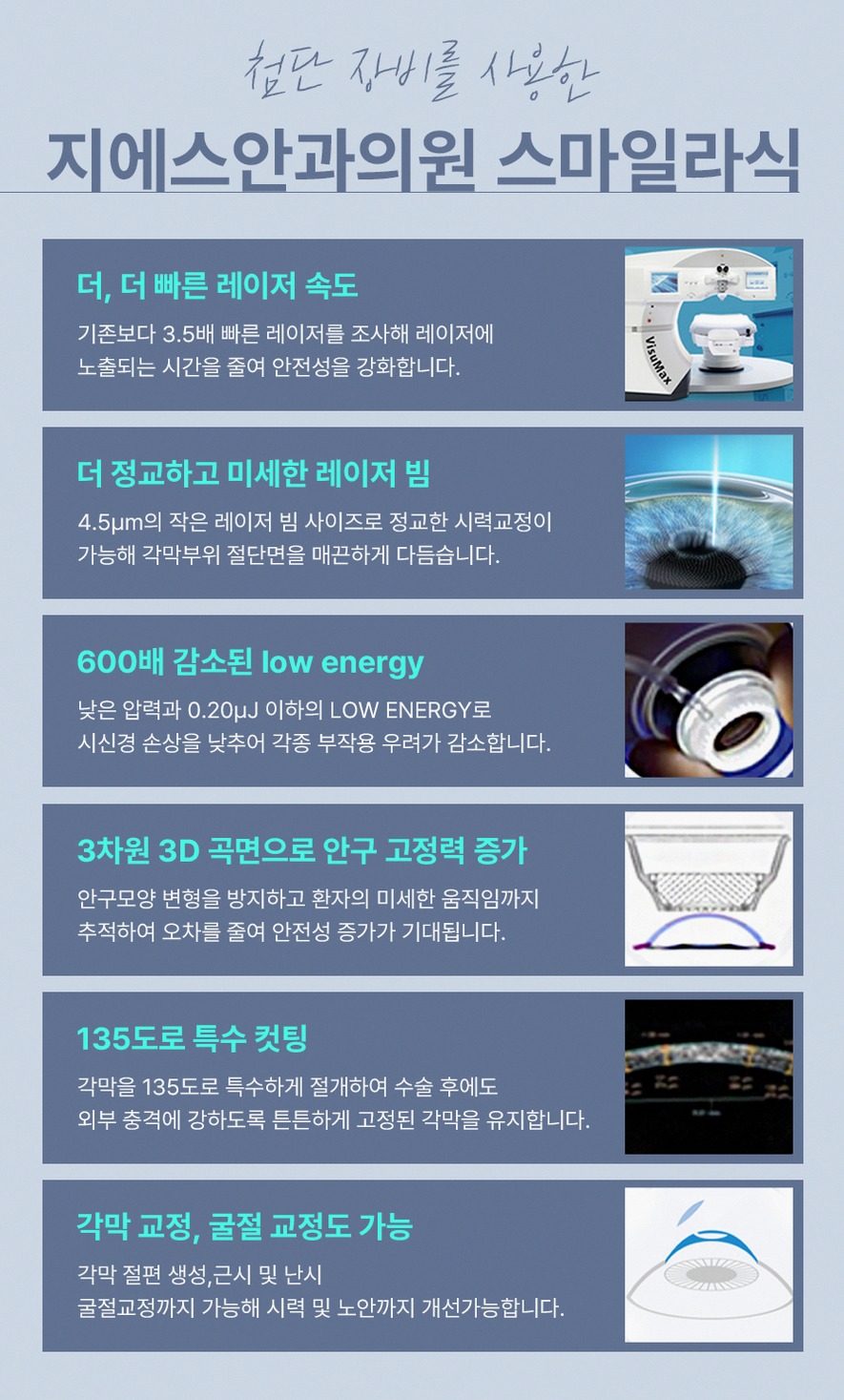 스마일라식수술시간 실제 소요시간과 회복기간 핵심 정보 14 1773912045 13 cfab050f
