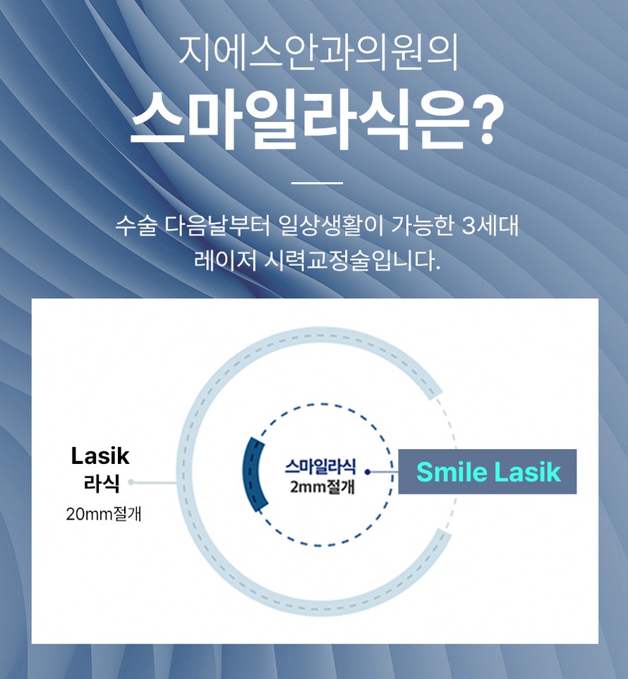 40대라식 후회 줄이는 3가지 선택 기준 5 1773912045 4 5180f4dd