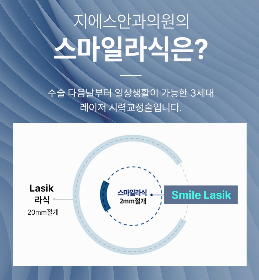 강남스마일라식효과 후회 줄이는 5가지 핵심 정보 5 1773912045 4 72be9f35