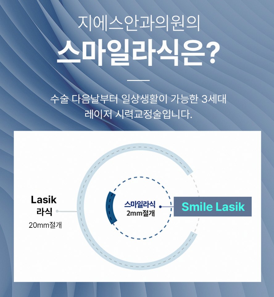 강남스마일라식효과 후회 줄이는 3가지 핵심 포인트 5 1773912045 4 80de3eba