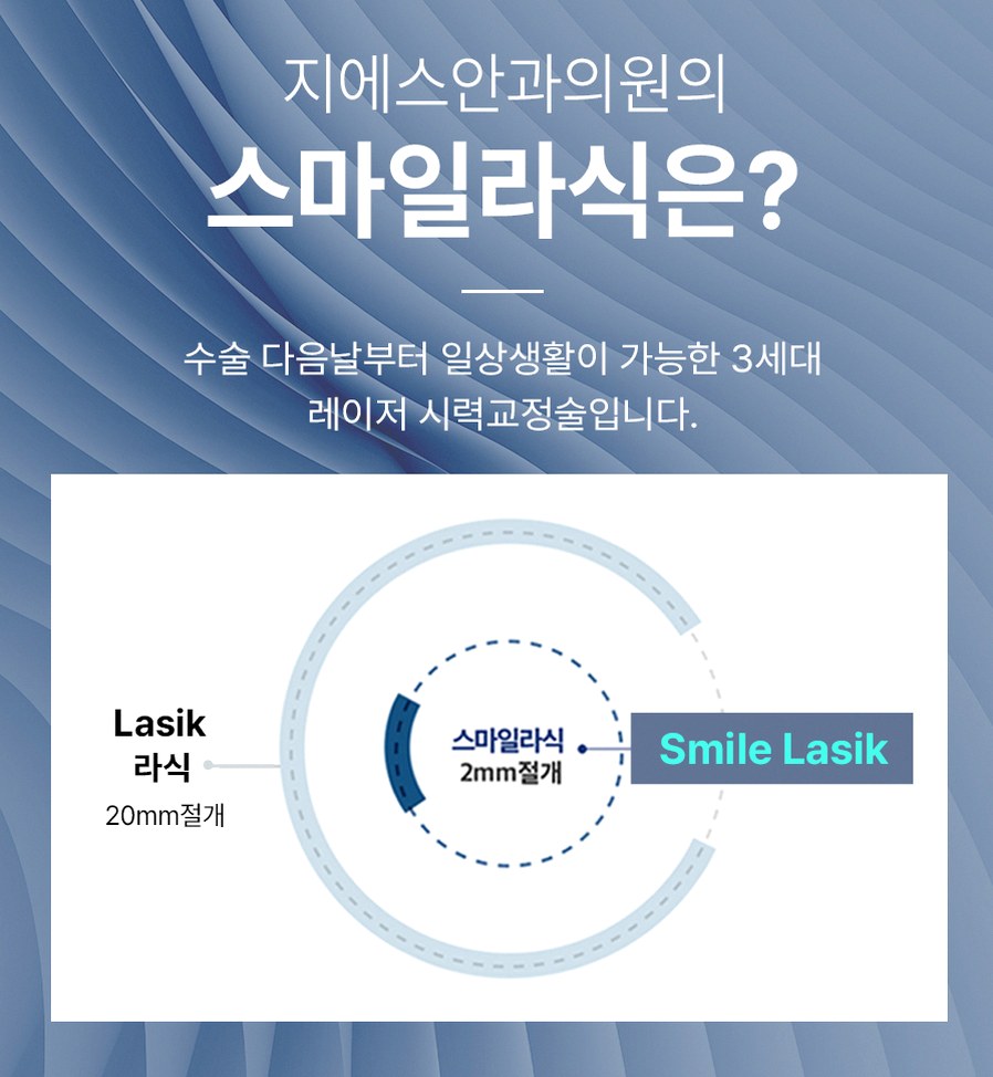 강남스마일라식추천 부작용 줄이기 전후 비교 핵심 기준 5 1773912045 4 ec8f71a6