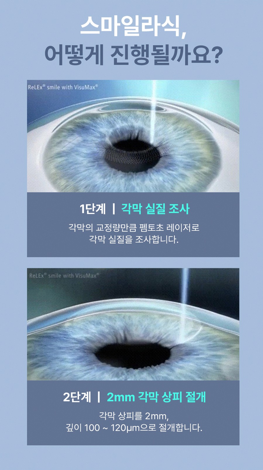 강남구스마트라식잘하는곳 선택 전 꼭 확인할 핵심 기준 7 1773912045 6 91345081