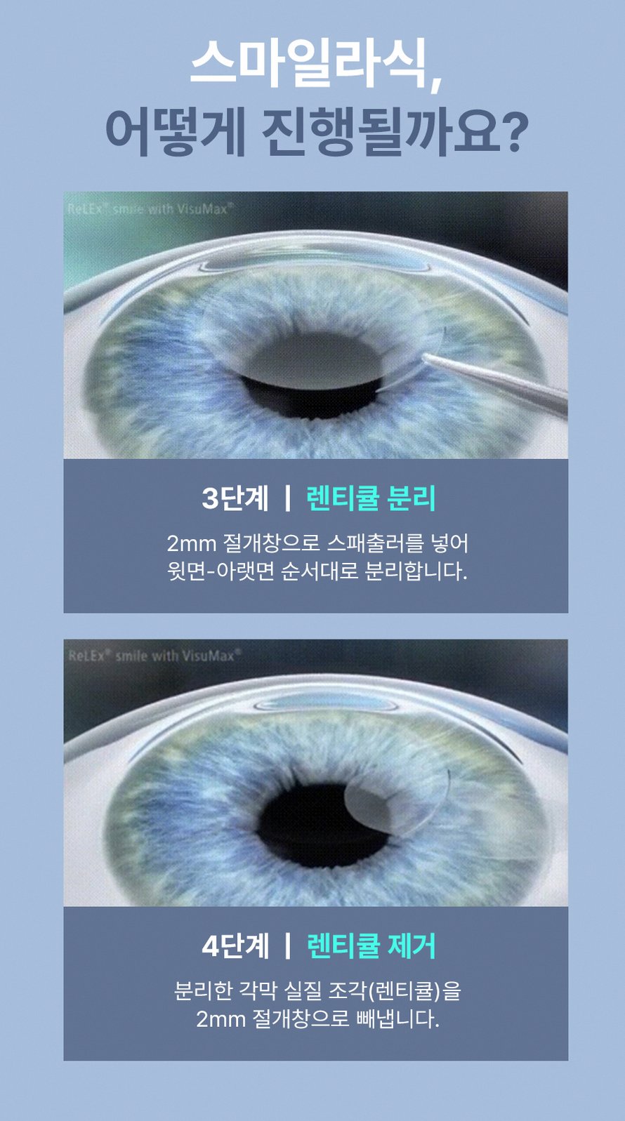강남구스마트라식잘하는곳 선택 전 꼭 확인할 핵심 기준 8 1773912045 7 8a7aa832