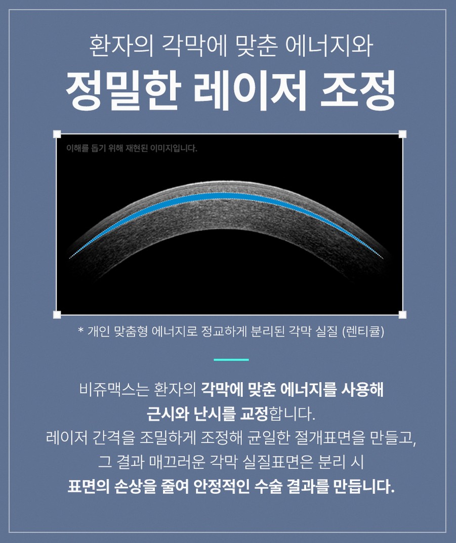 강남스마일라식효과 후회 줄이는 5가지 핵심 정보 10 1773912045 9 2fc97cb1