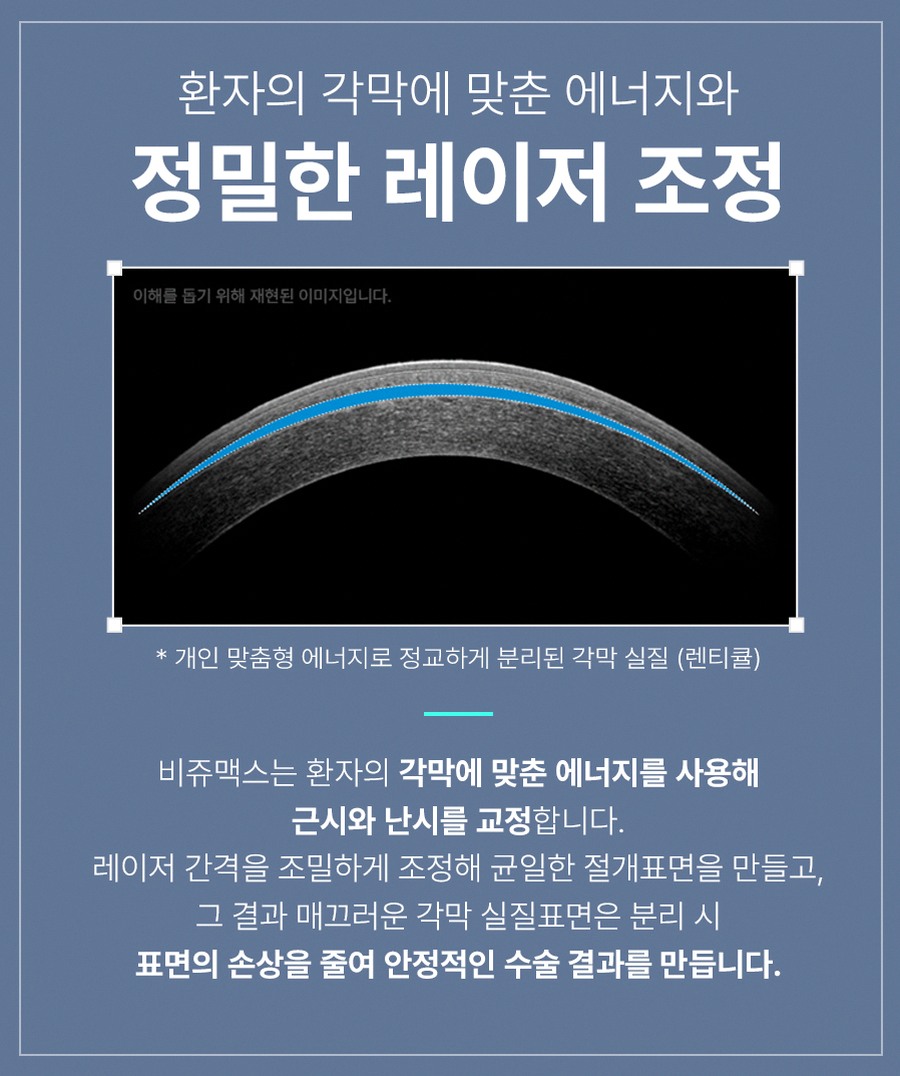 강남스마일라식효과 후회 줄이는 3가지 핵심 포인트 10 1773912045 9 a11a47b6
