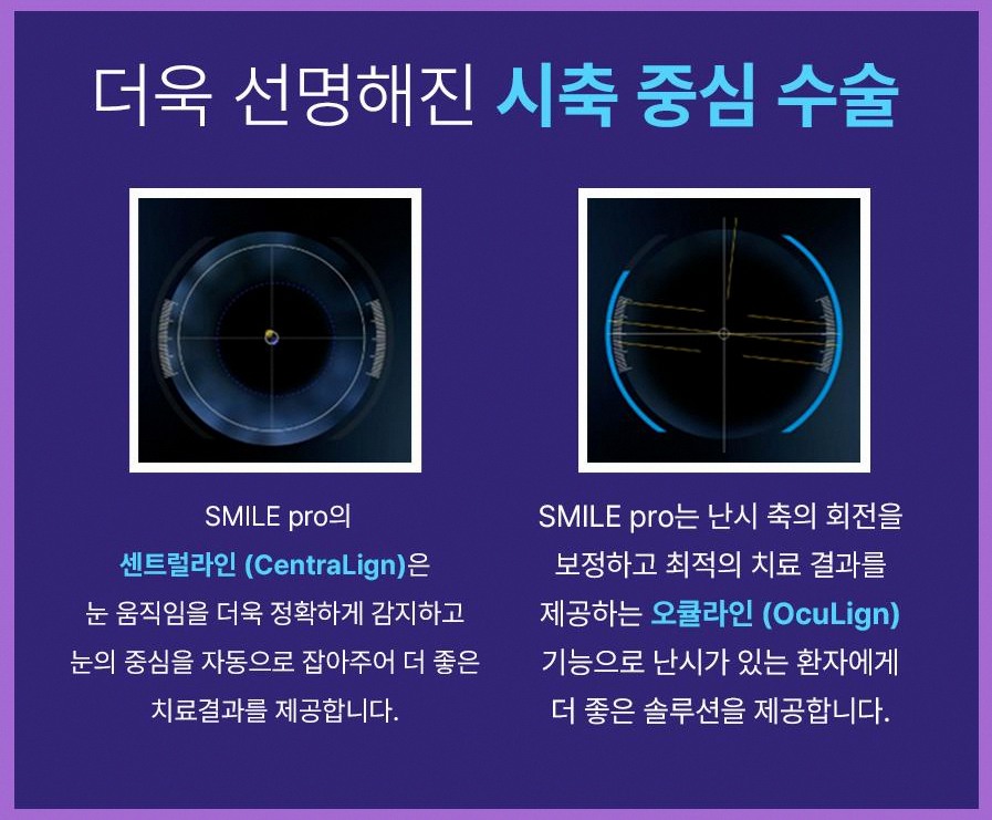 스마일라식정보 안내 실제 경험담에서 드러난 3가지 핵심 포인트 6 1773912084 5 2840f49f