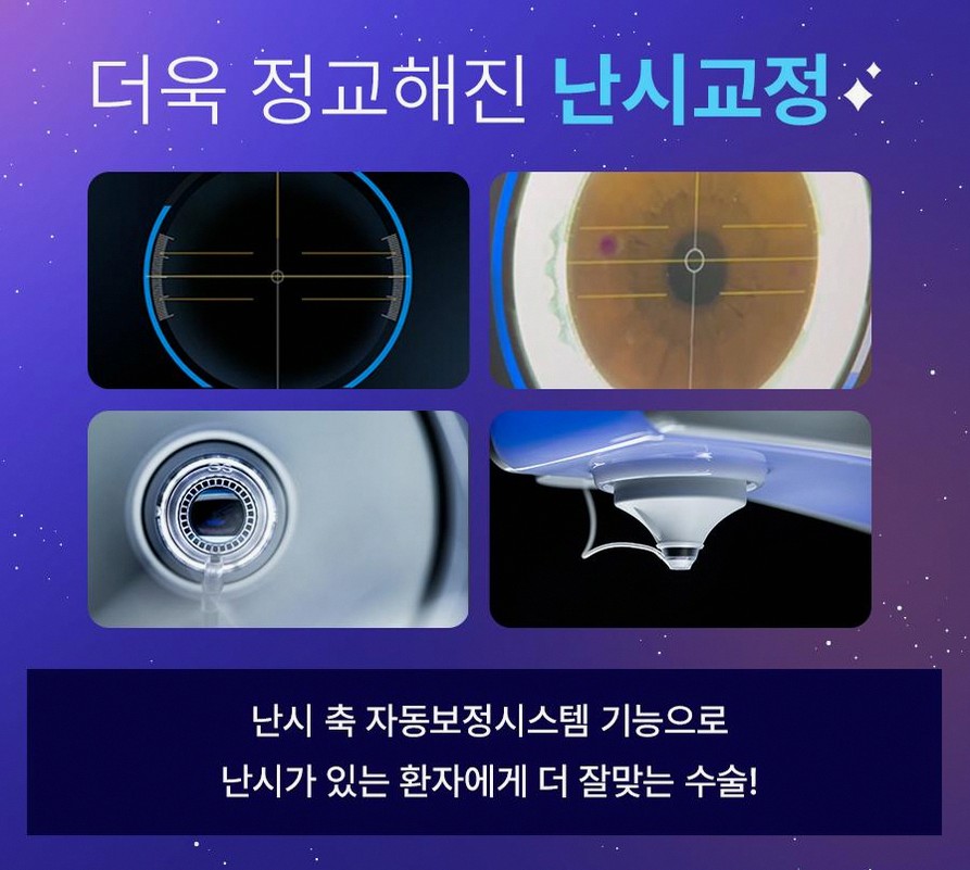 스마일라식정보 안내 실제 경험담에서 드러난 3가지 핵심 포인트 7 1773912084 6 ef030037