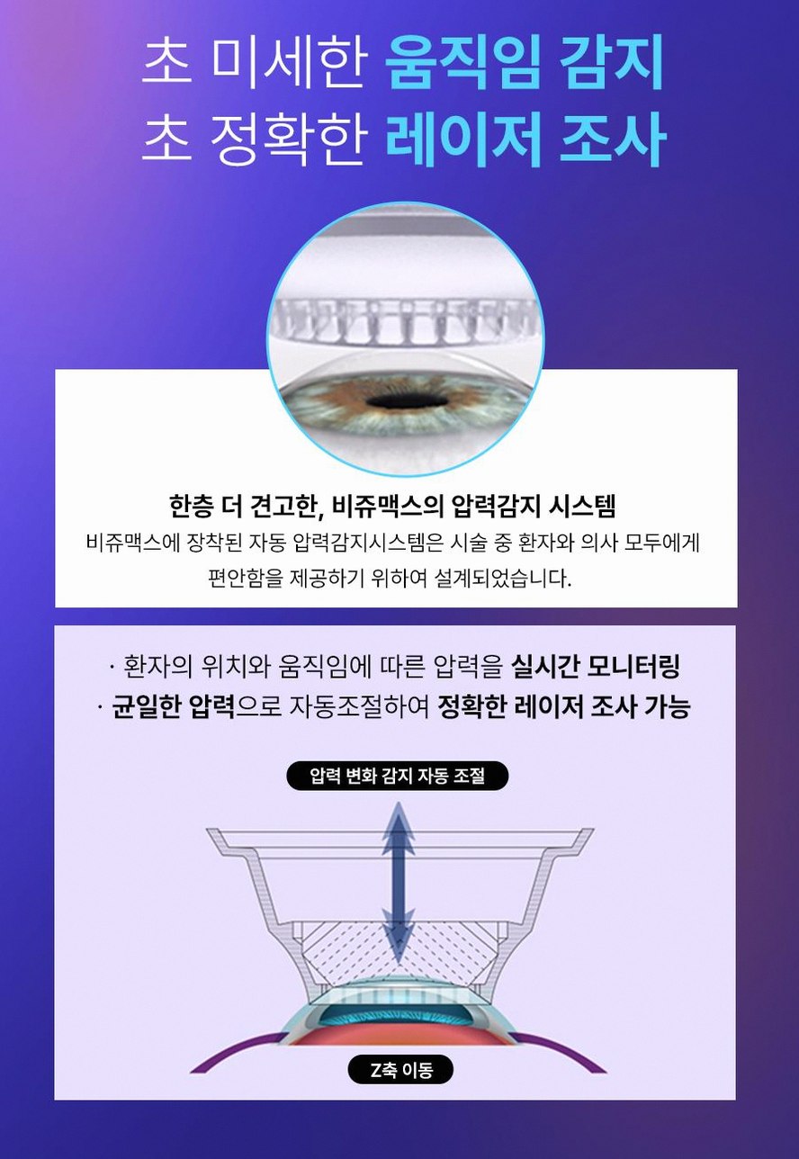 스마일라식정보 안내 실제 경험담에서 드러난 3가지 핵심 포인트 9 1773912084 8 1c2e32b5