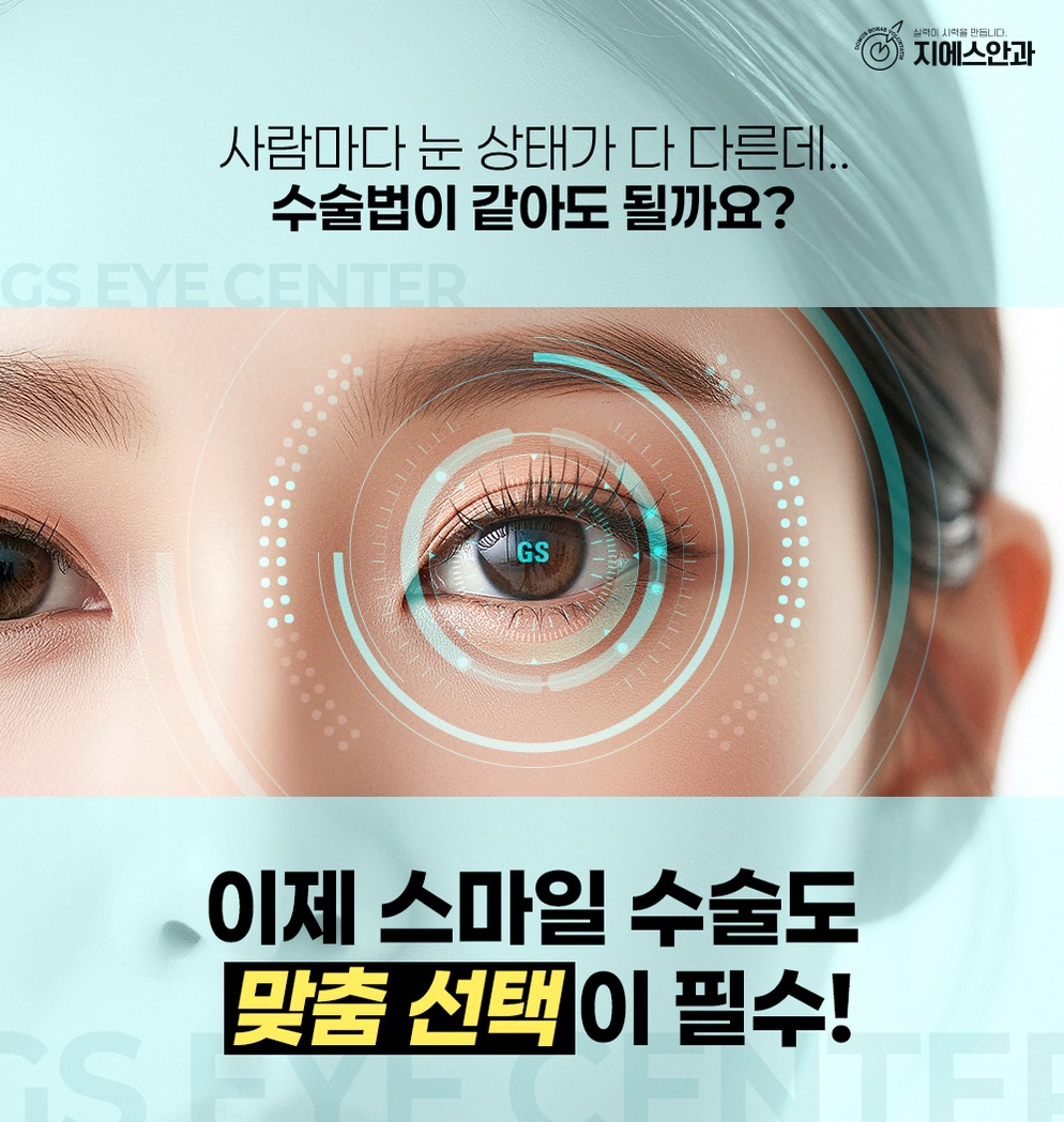 스마일라식다음날 눈상태 변화와 주의사항 5 1776826450 4 00ef3b37