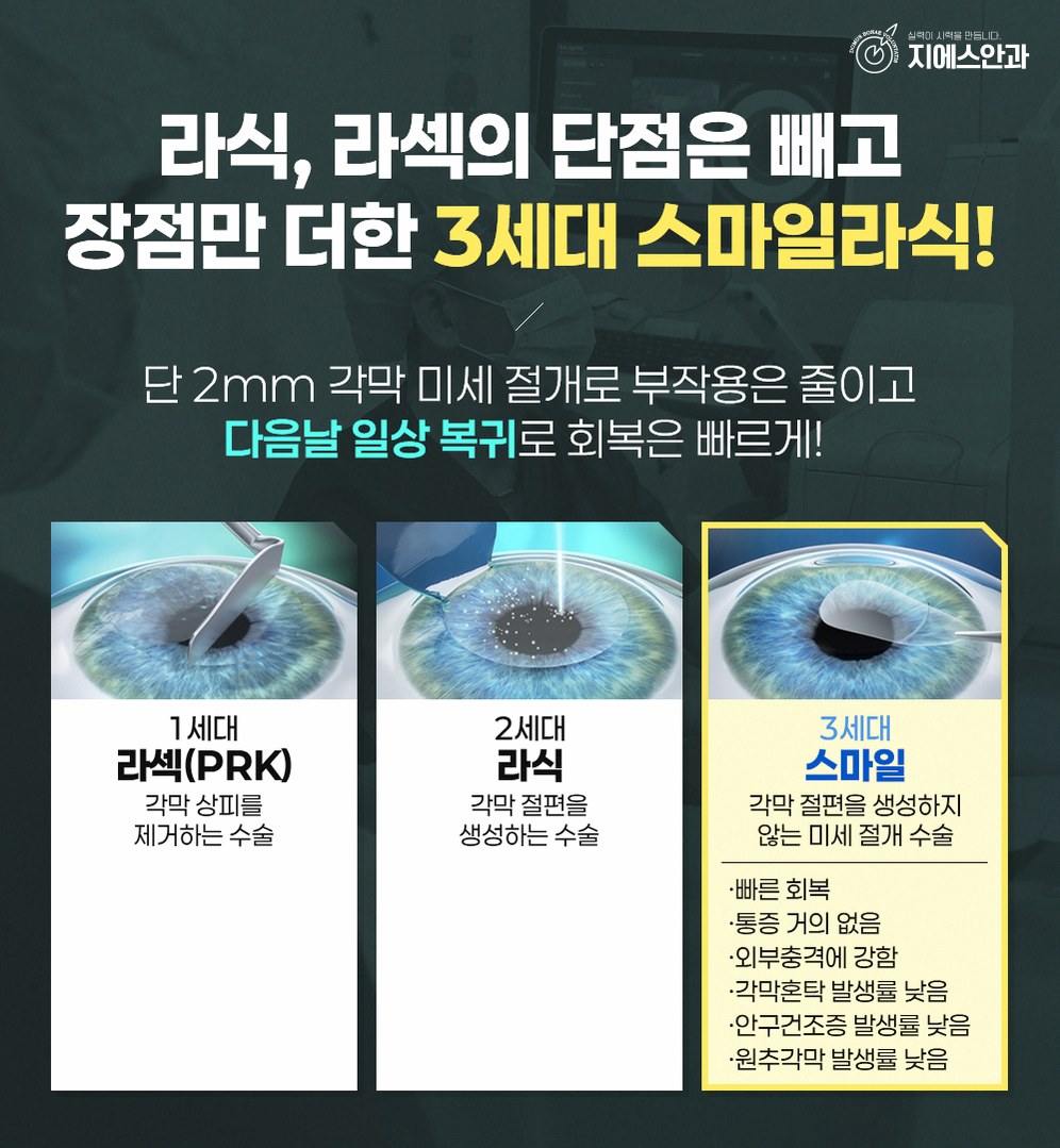 난시교정 종류와 선택 기준 정리 9 1776826450 8 27bf5eab