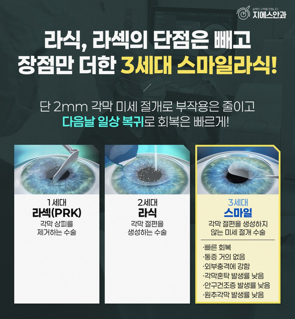 스마일라식다음날 눈상태 변화와 주의사항 9 1776826450 8 716e980a