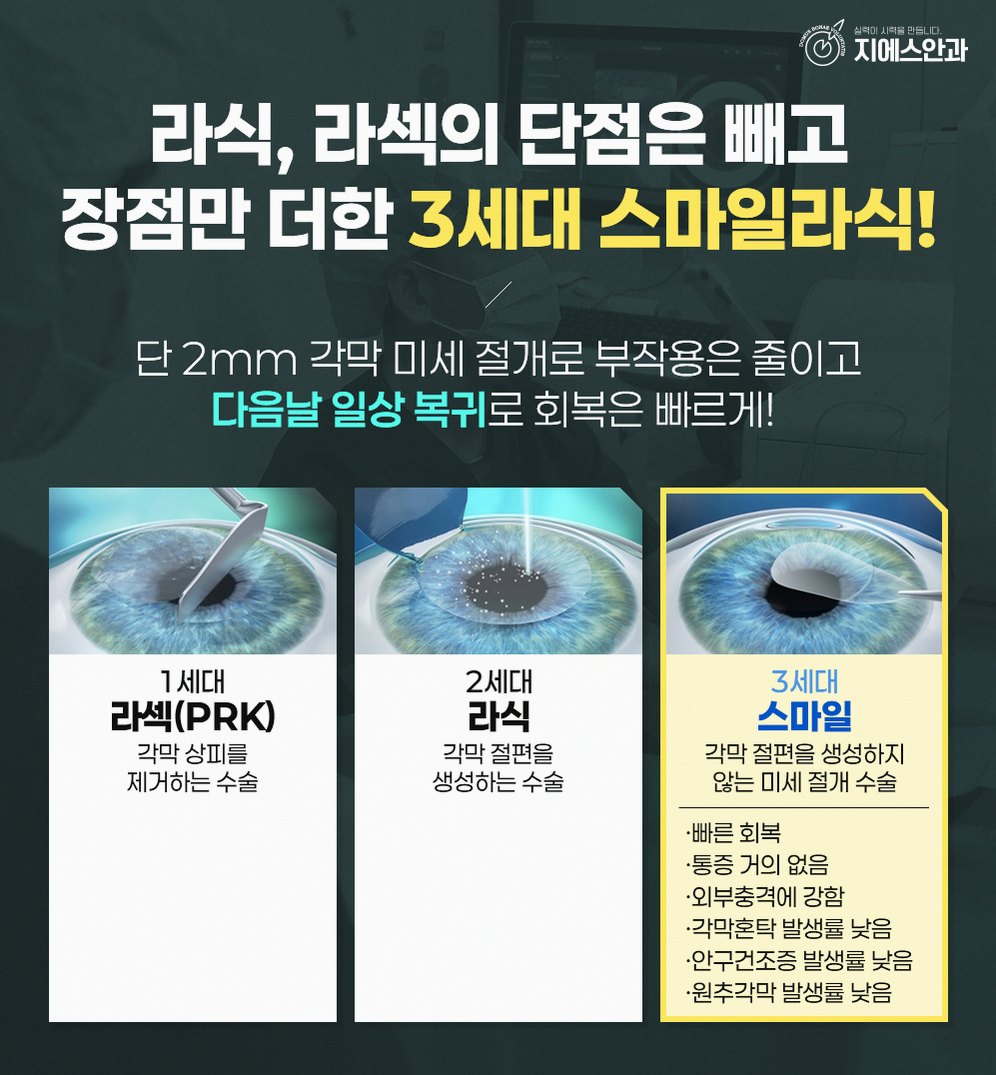선릉역 안과 시력교정 수술, 기대할 수 있는 효과 정리 9 본문 내용을 보조하는 이미지