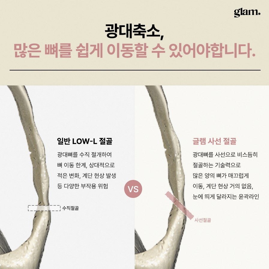본문 내용을 보조하는 이미지