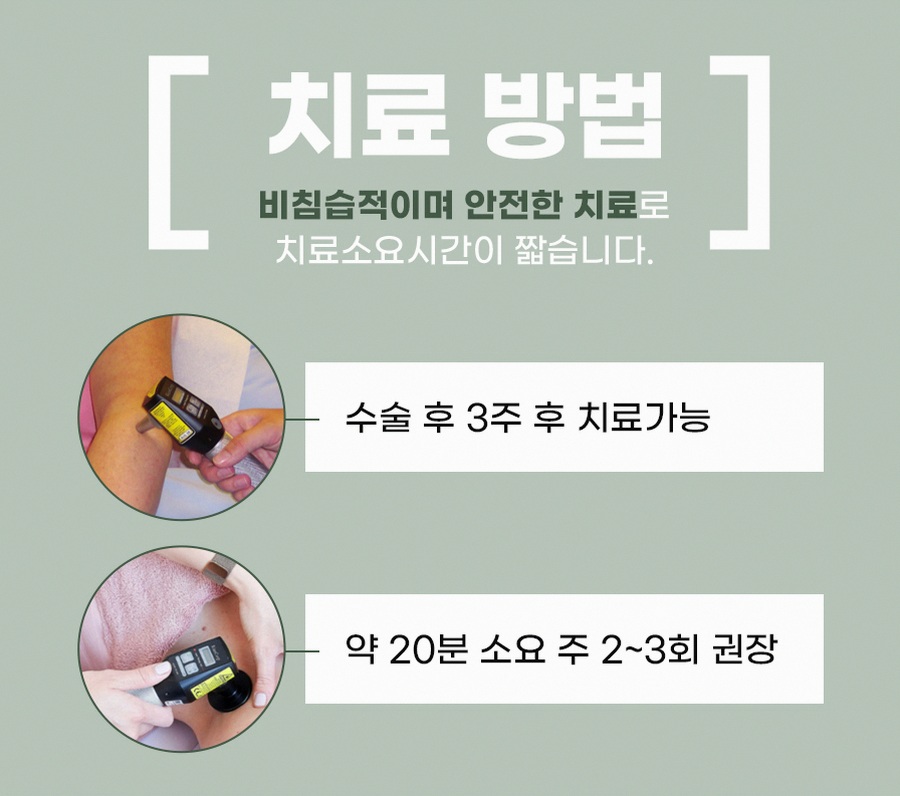 본문 내용을 보조하는 이미지