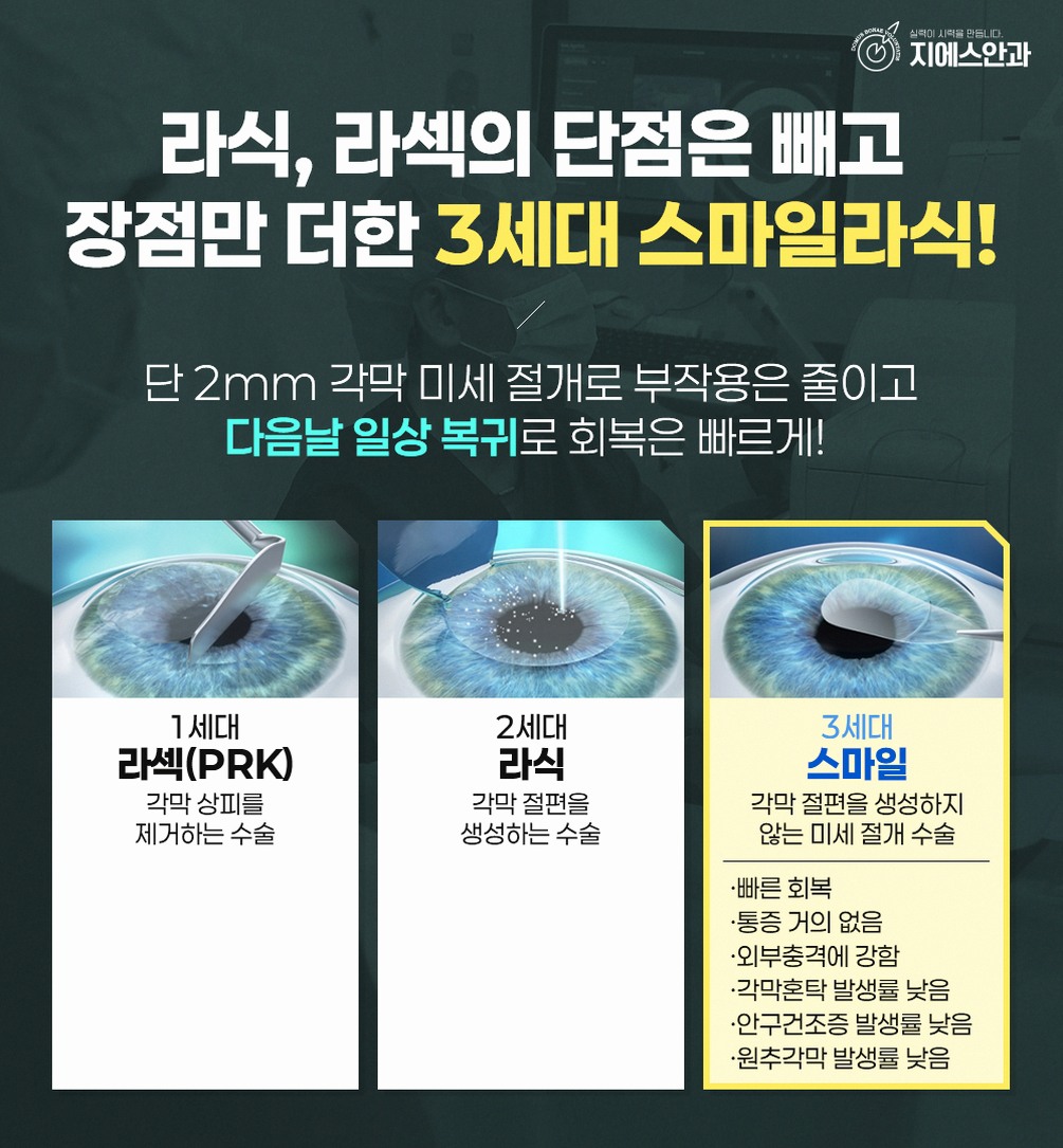 신사역 시력교정술 정보 안내, 수술 전후 과정과 체크사항 9 본문 내용을 보조하는 이미지
