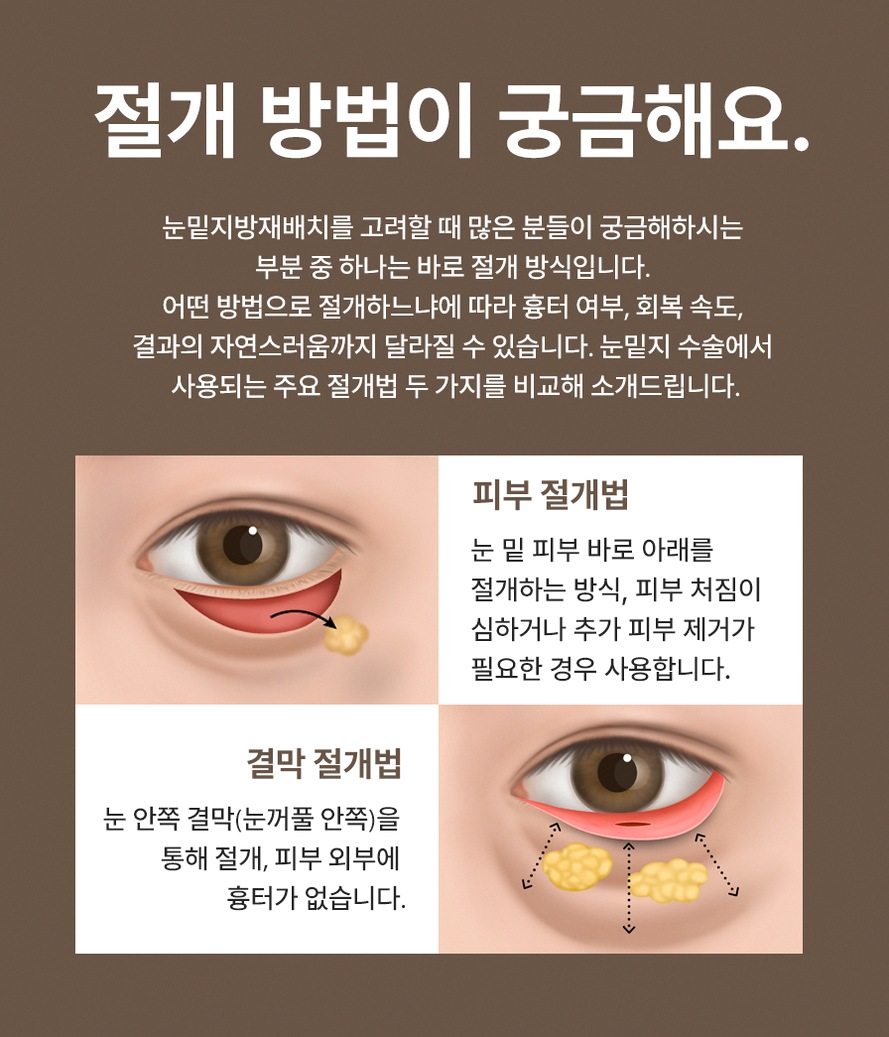 본문 내용을 보조하는 이미지