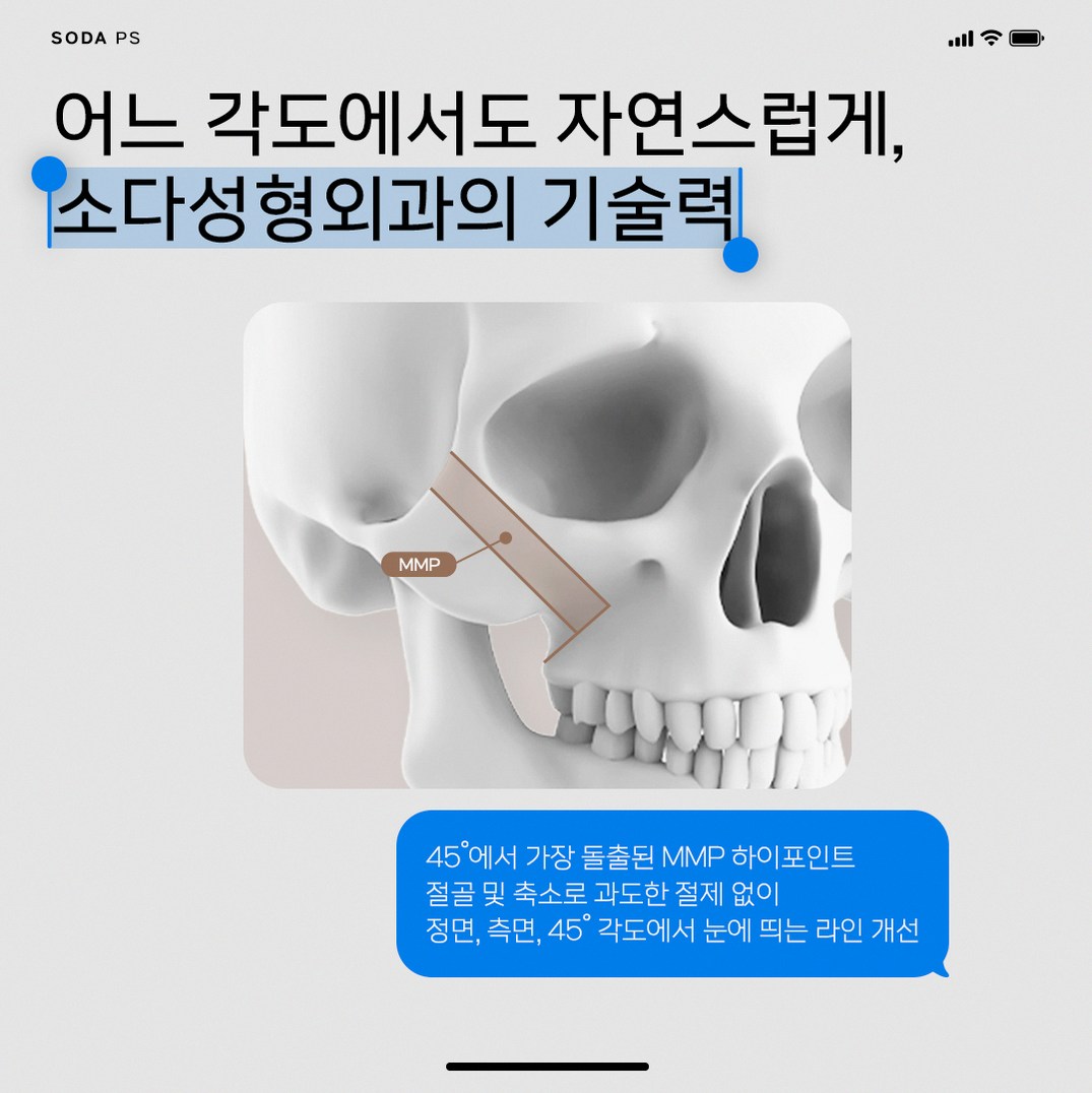 본문 내용을 보조하는 이미지