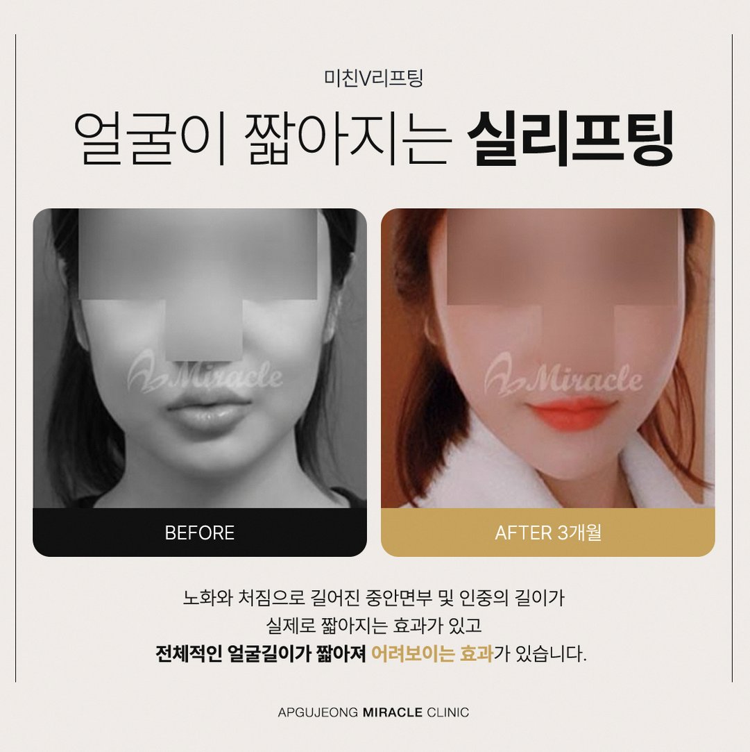 본문 내용을 보조하는 이미지