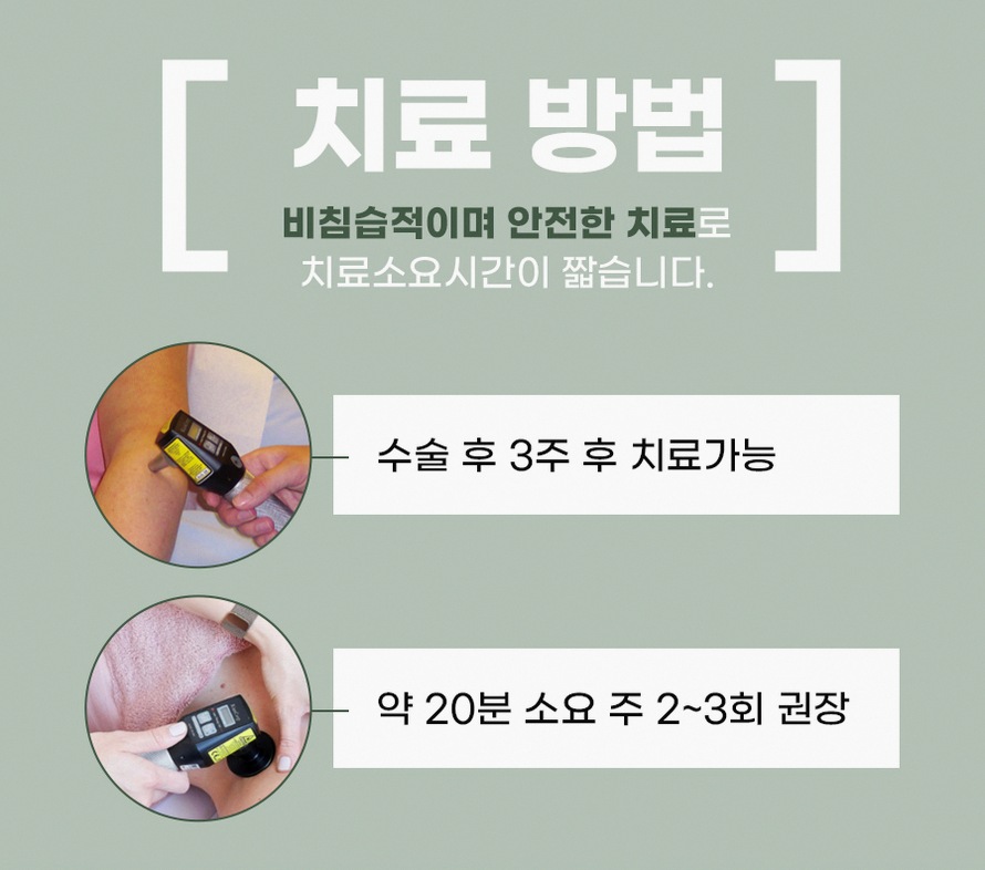 본문 내용을 보조하는 이미지