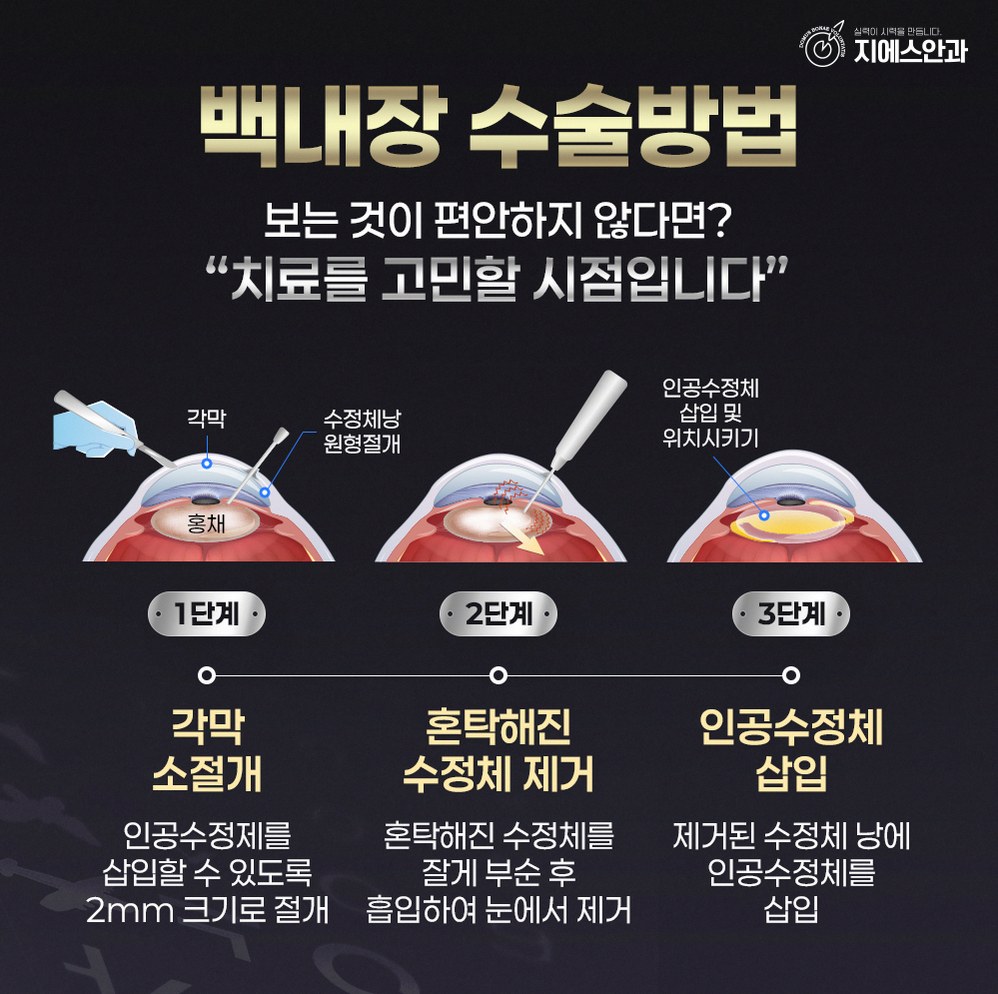 본문 내용을 보조하는 이미지