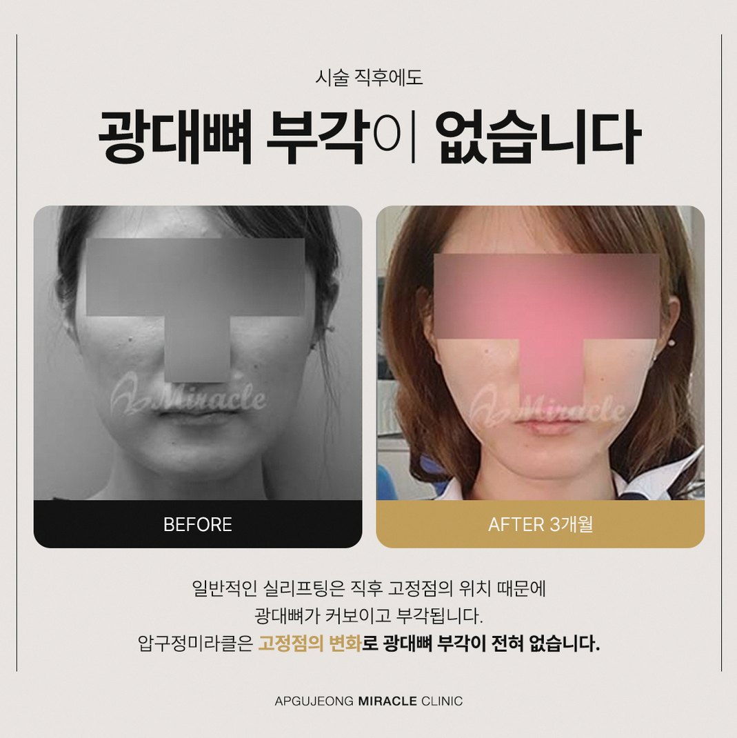 본문 내용을 보조하는 이미지