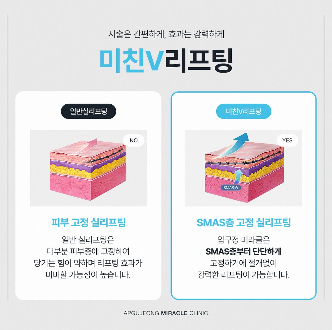 본문 내용을 보조하는 이미지