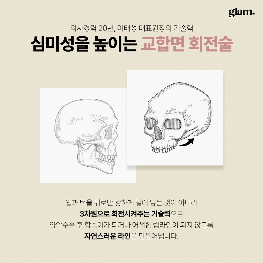 본문 내용을 보조하는 이미지