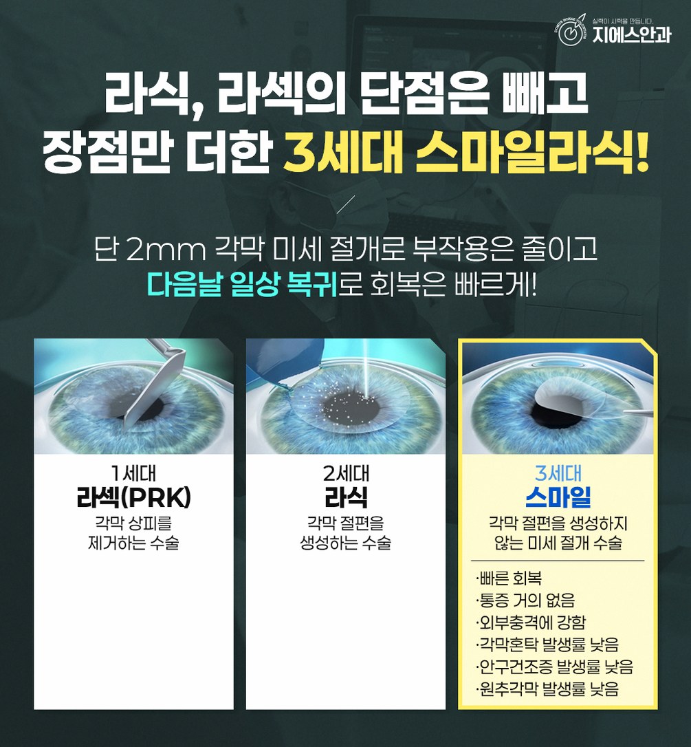 서초역 스마일라식 잘하는 곳 선택 전 확인사항 9 본문 내용을 보조하는 이미지