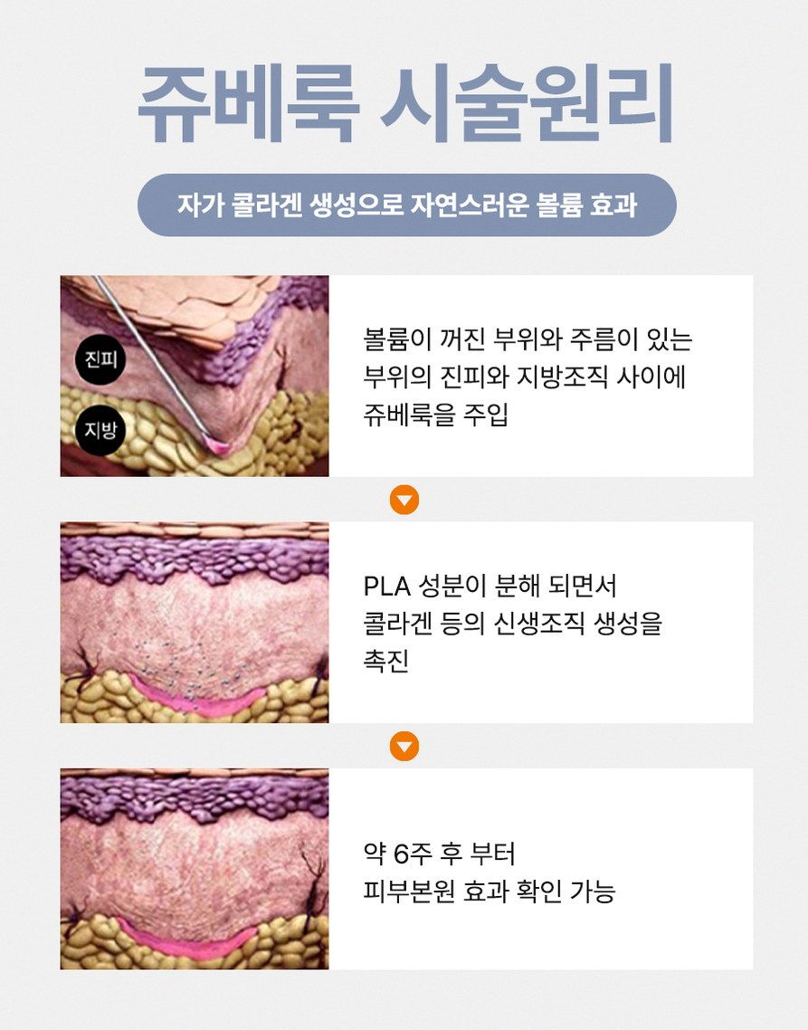 본문 내용을 보조하는 이미지