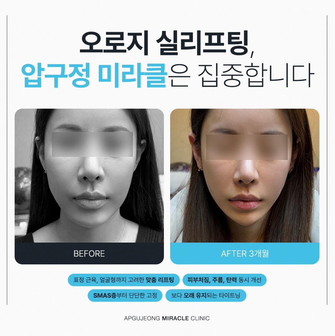 본문 내용을 보조하는 이미지