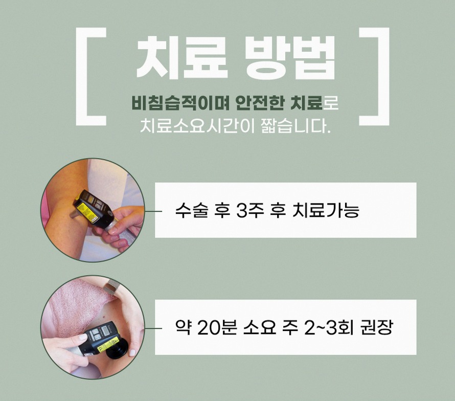 본문 내용을 보조하는 이미지