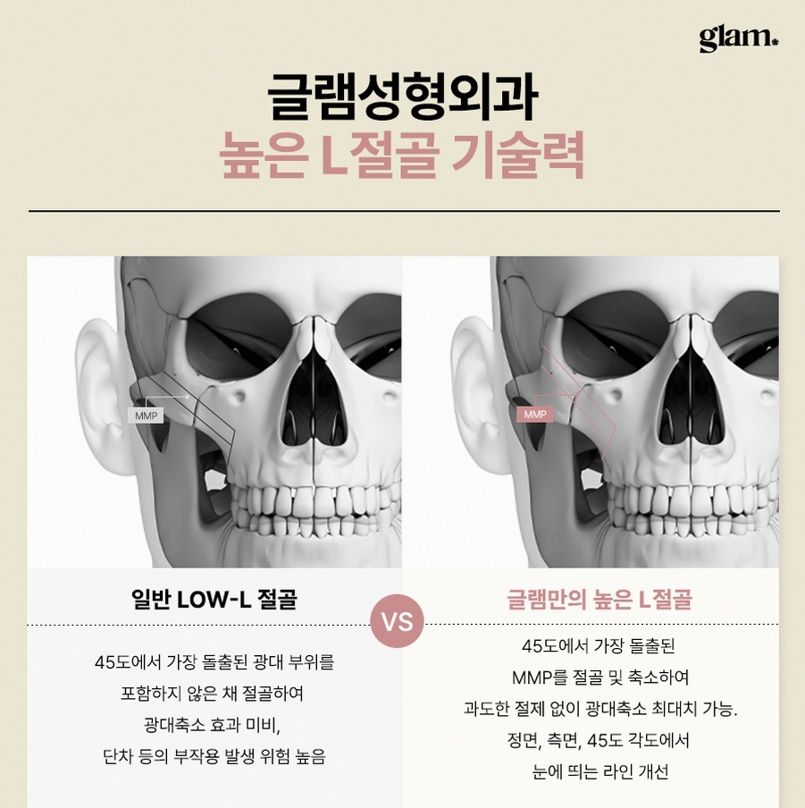 본문 내용을 보조하는 이미지