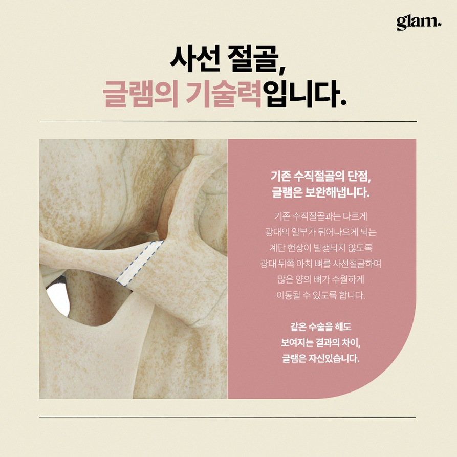 본문 내용을 보조하는 이미지