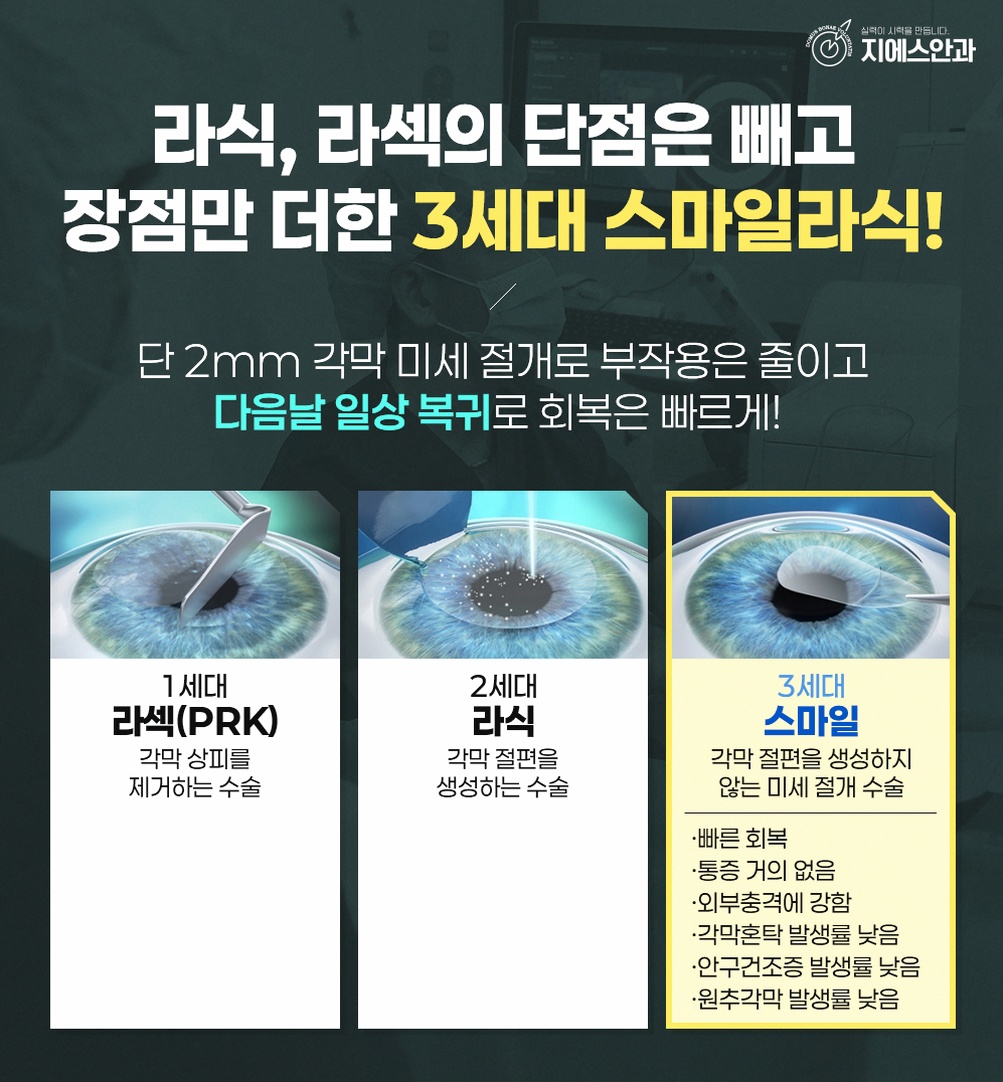 압구정스마트라식비용 시력·각막 상태에 따라 달라지는 항목 9 본문 내용을 보조하는 이미지