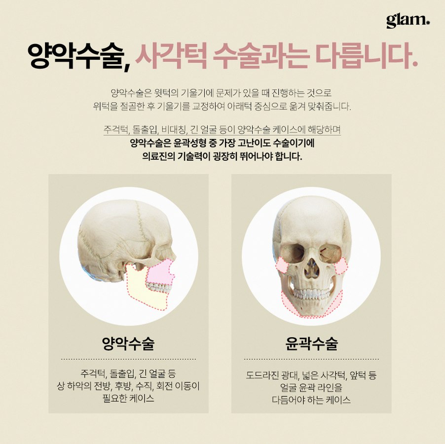 본문 내용을 보조하는 이미지