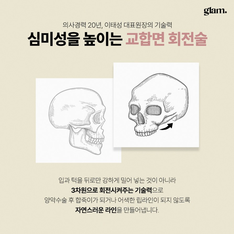 본문 내용을 보조하는 이미지