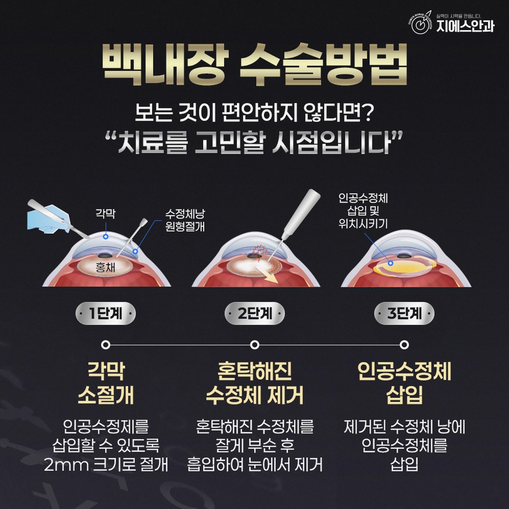 본문 내용을 보조하는 이미지