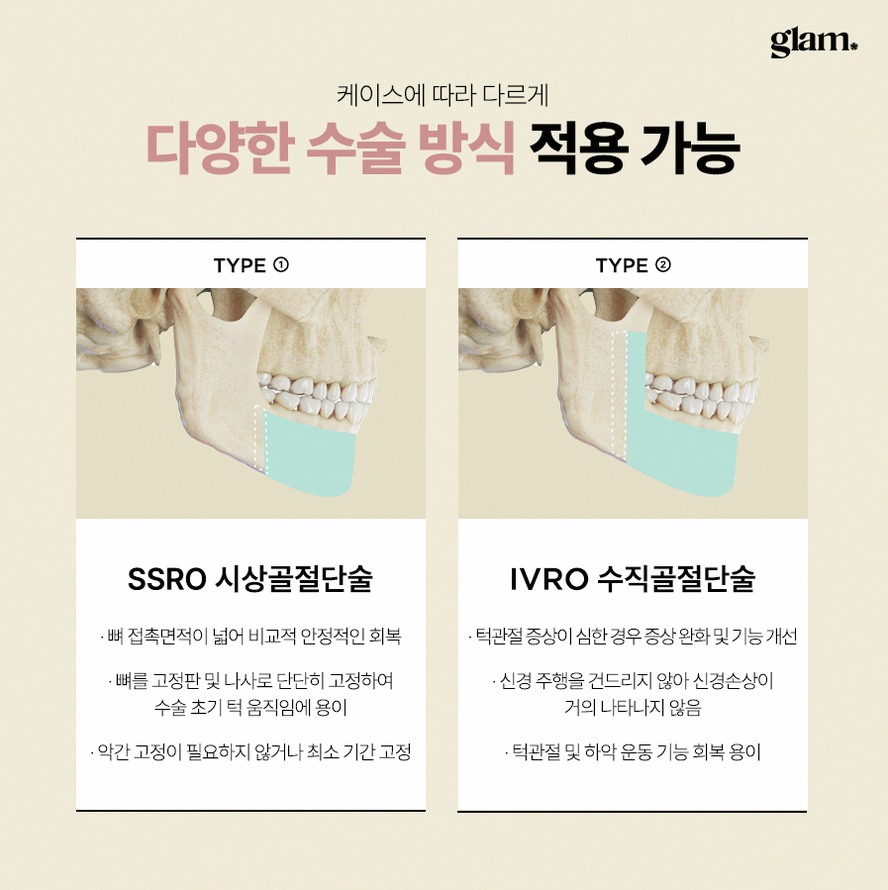 본문 내용을 보조하는 이미지