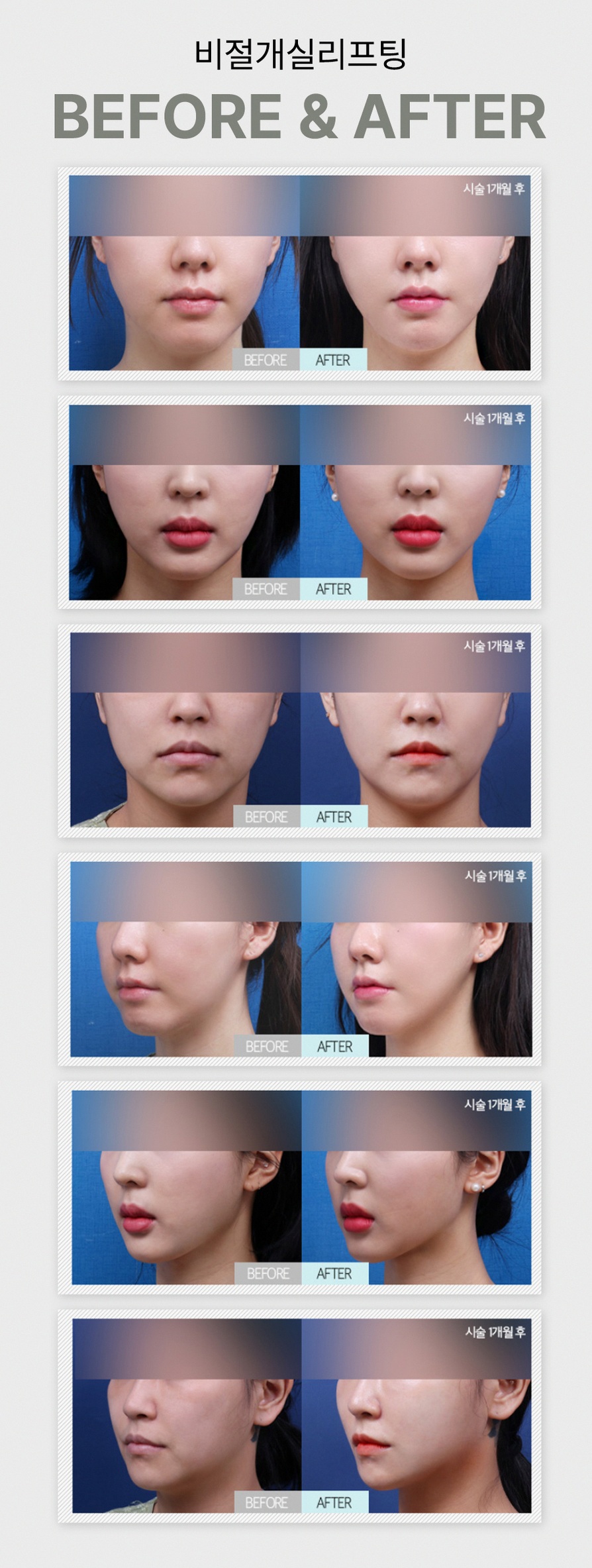 본문 내용을 보조하는 이미지
