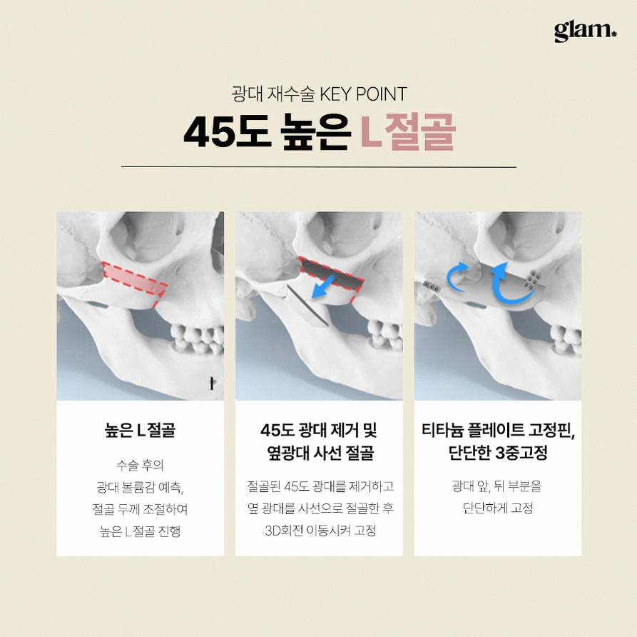 본문 내용을 보조하는 이미지