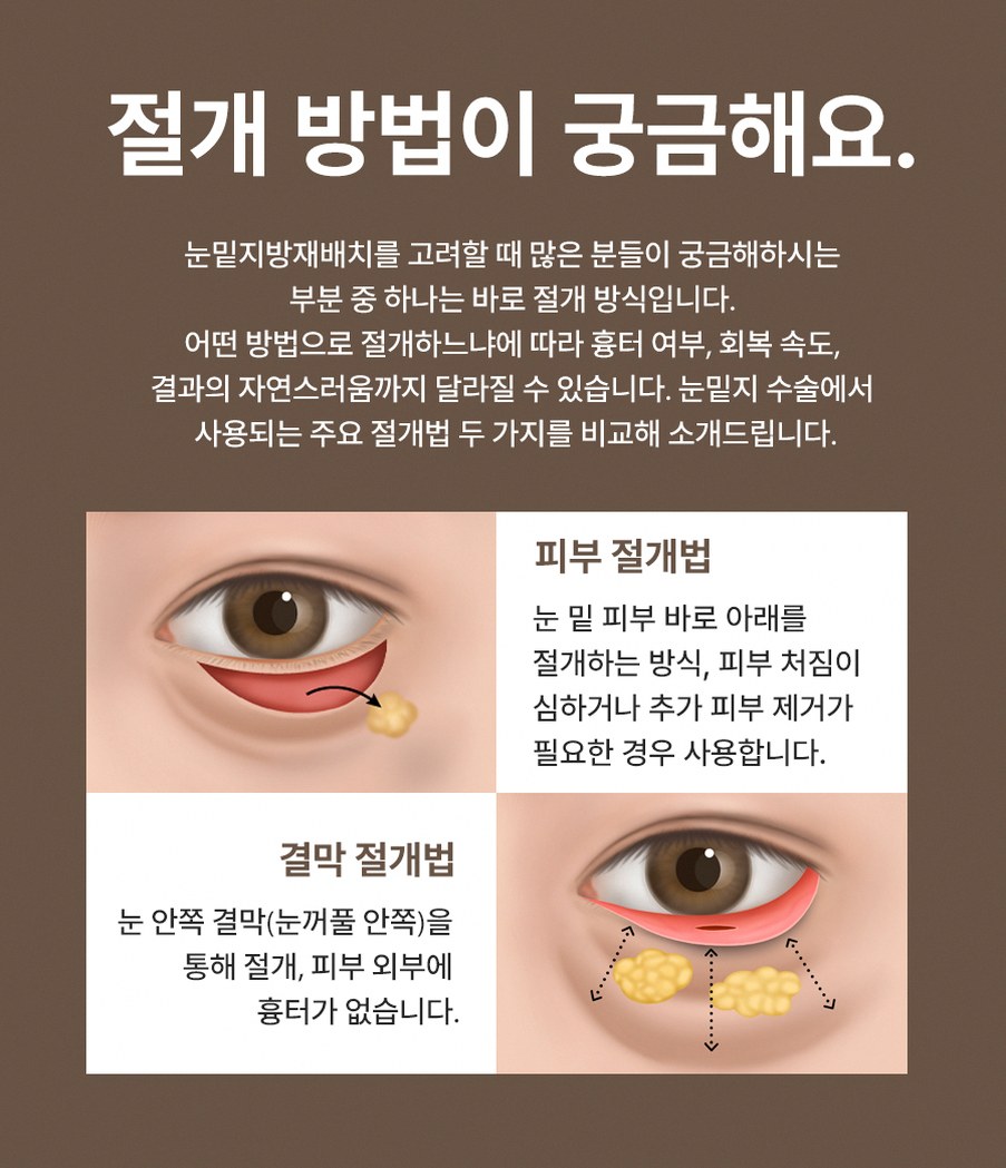 본문 내용을 보조하는 이미지